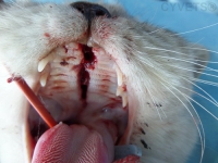 Midsagittal fracture of the hard palate